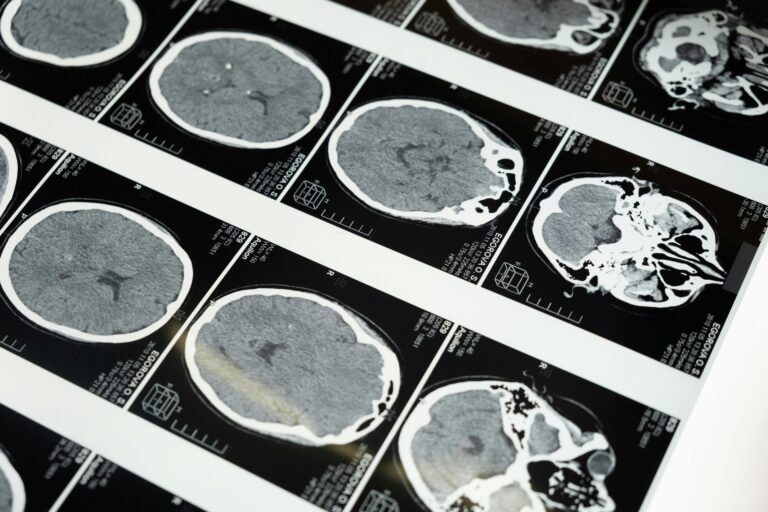 Human Brain At Risk Due To Climate Crisis